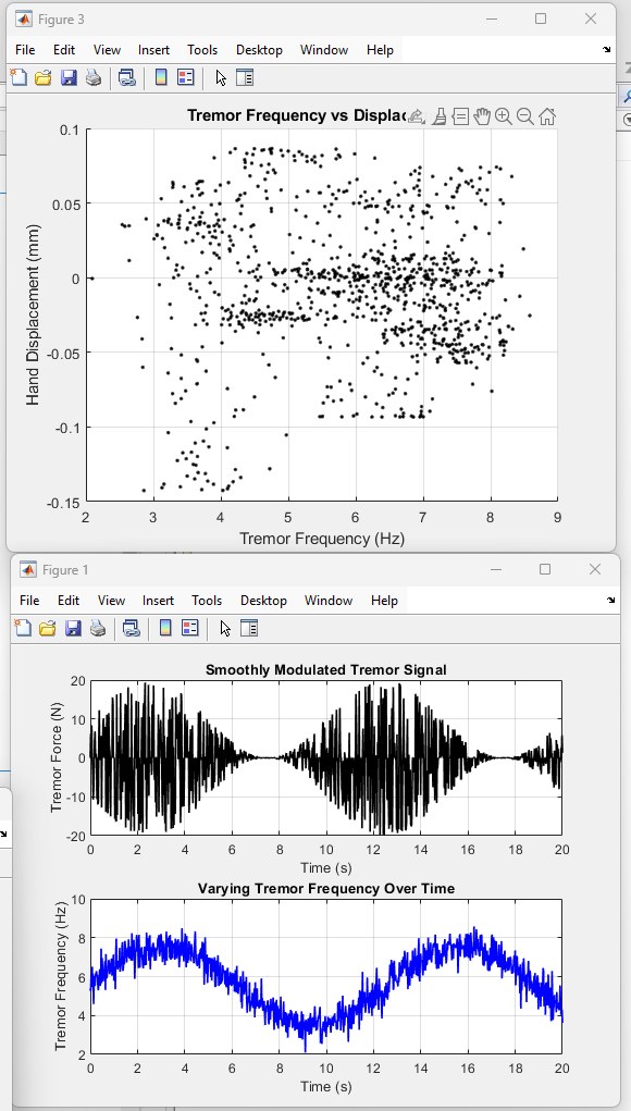MATLAB plots of the modulated tremor signal, varying frequency, and frequency versus displacement